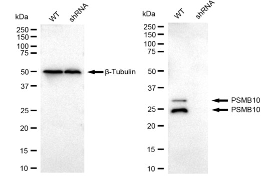 PSMB10/MECL1 Antibody (23GB2165)