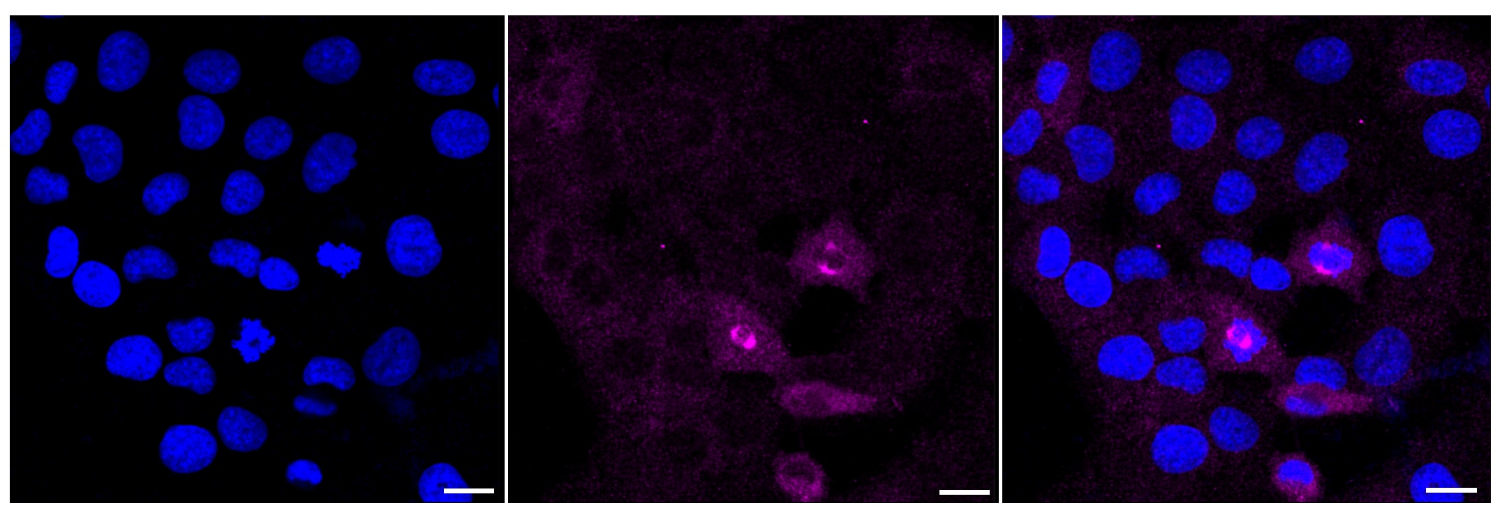 TAK1 [p Ser439] Antibody (24GB725)