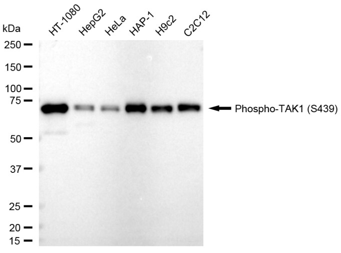 TAK1 [p Ser439] Antibody (24GB725)
