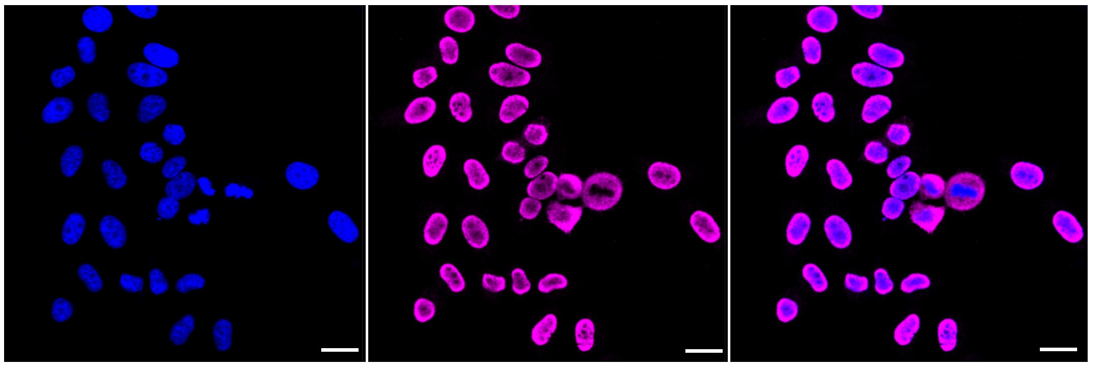 NM23-H1 Antibody (23GB2180)