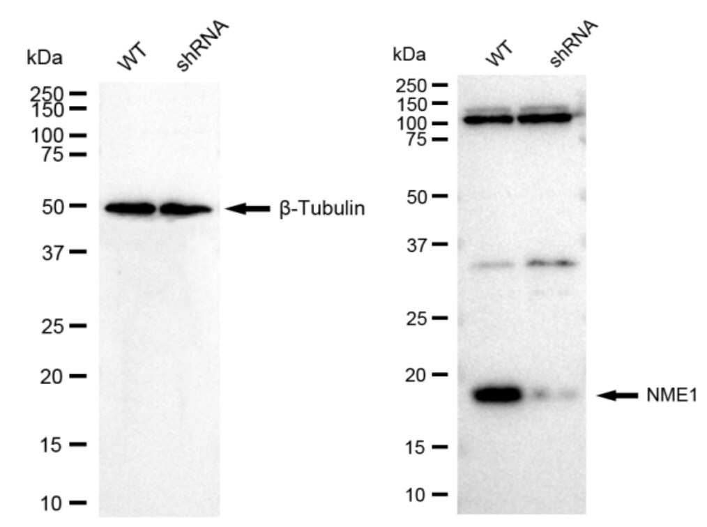 NM23-H1 Antibody (23GB2180)