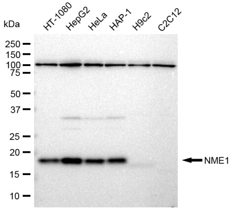 NM23-H1 Antibody (23GB2180)
