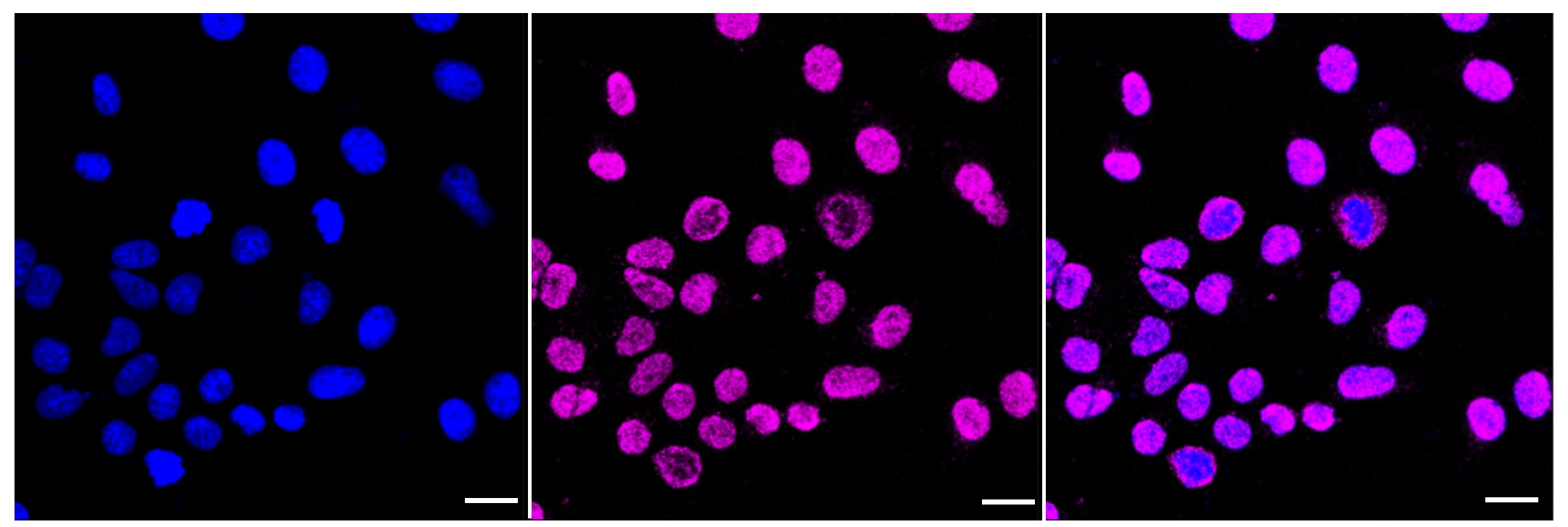 DDB1 Antibody (23GB2265)