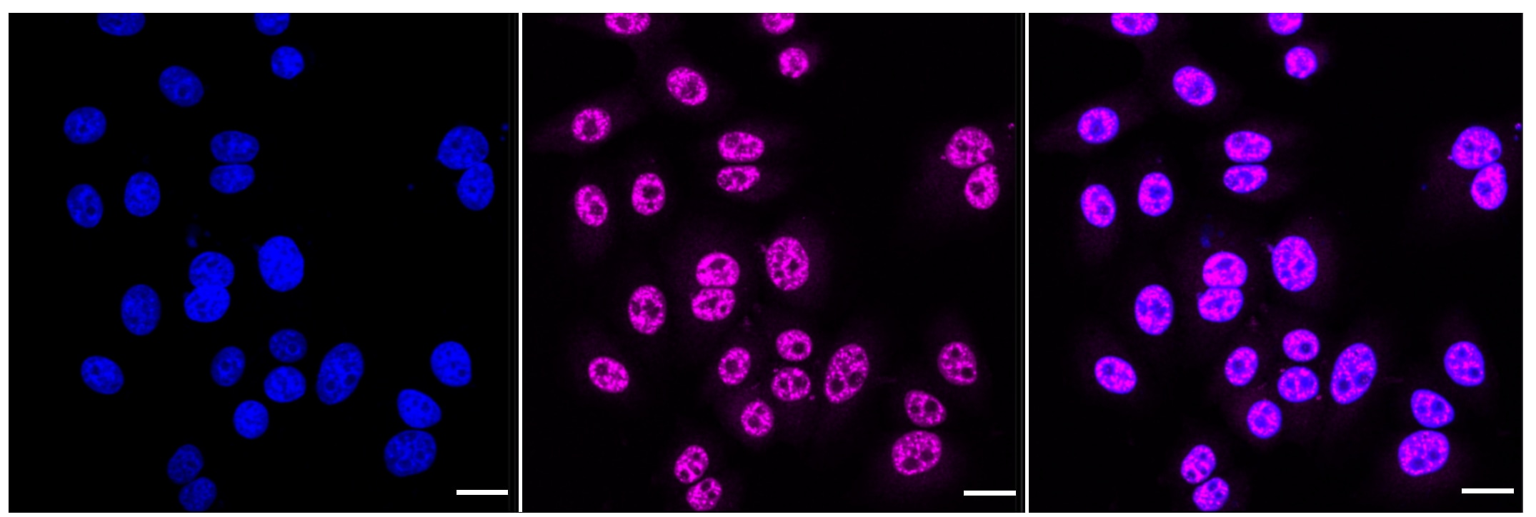PTS [p Ser19] Antibody (24GB800)