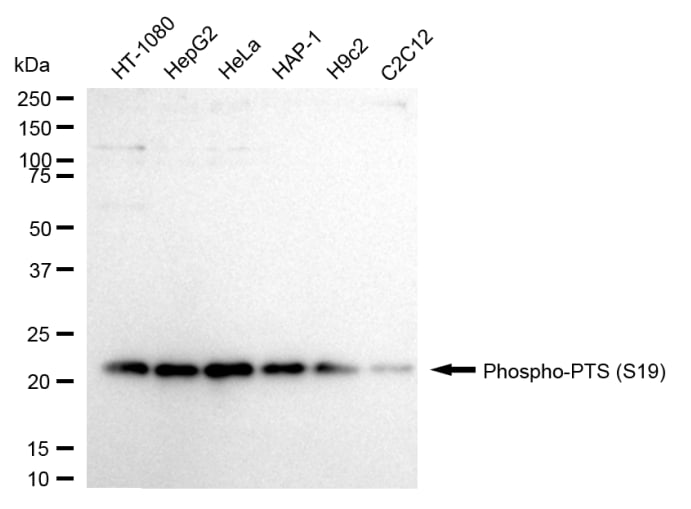 PTS [p Ser19] Antibody (24GB800)