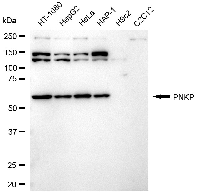 PNK Antibody (24GB805)