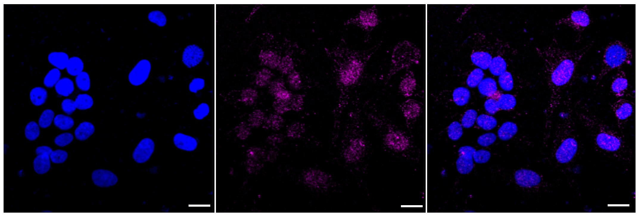 TAK1 Antibody (23GB2395)