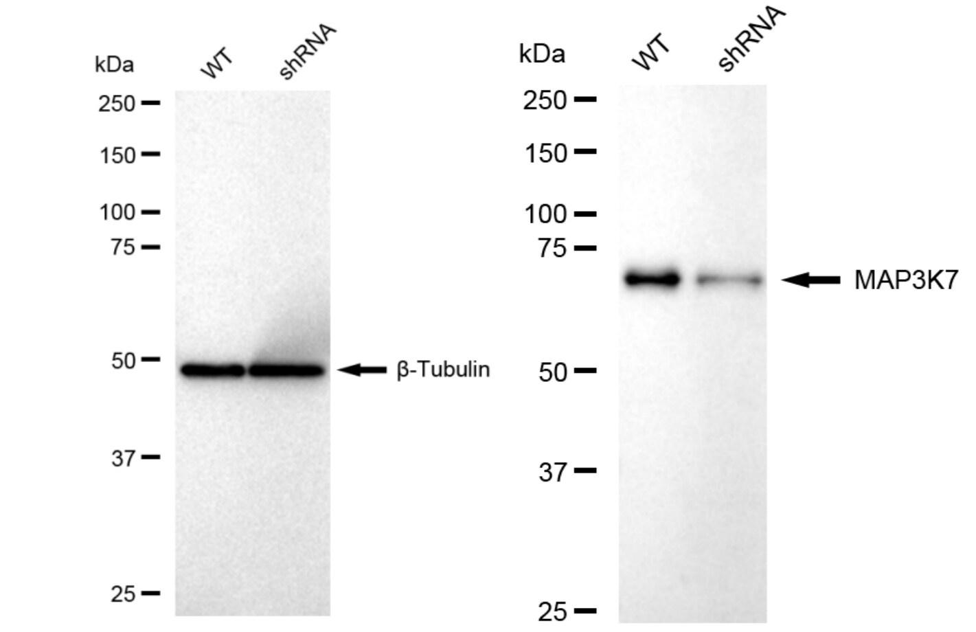 TAK1 Antibody (23GB2395)