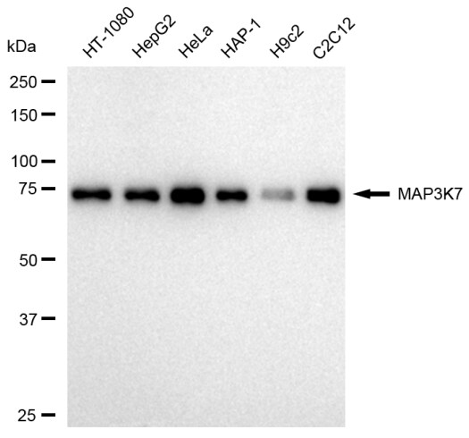 TAK1 Antibody (23GB2395)