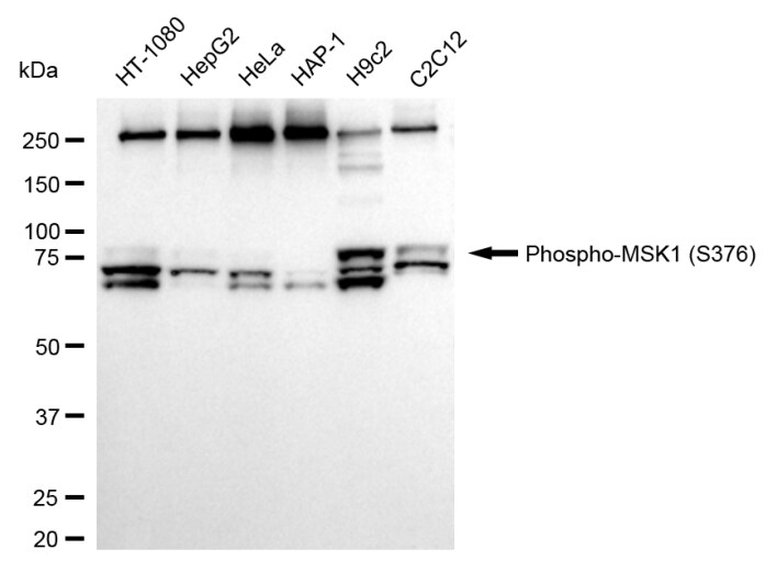 MSK1/RPS6KA5 [p Ser376] Antibody (24GB870)