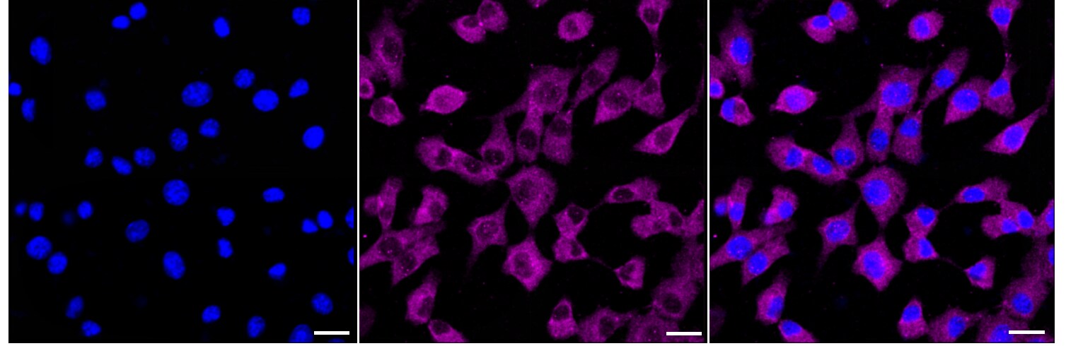 PKC Alpha/Beta/Gamma Antibody (24GB885)