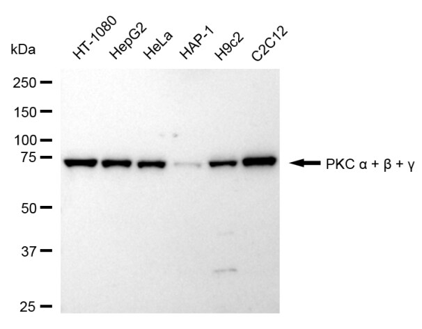 PKC Alpha/Beta/Gamma Antibody (24GB885)