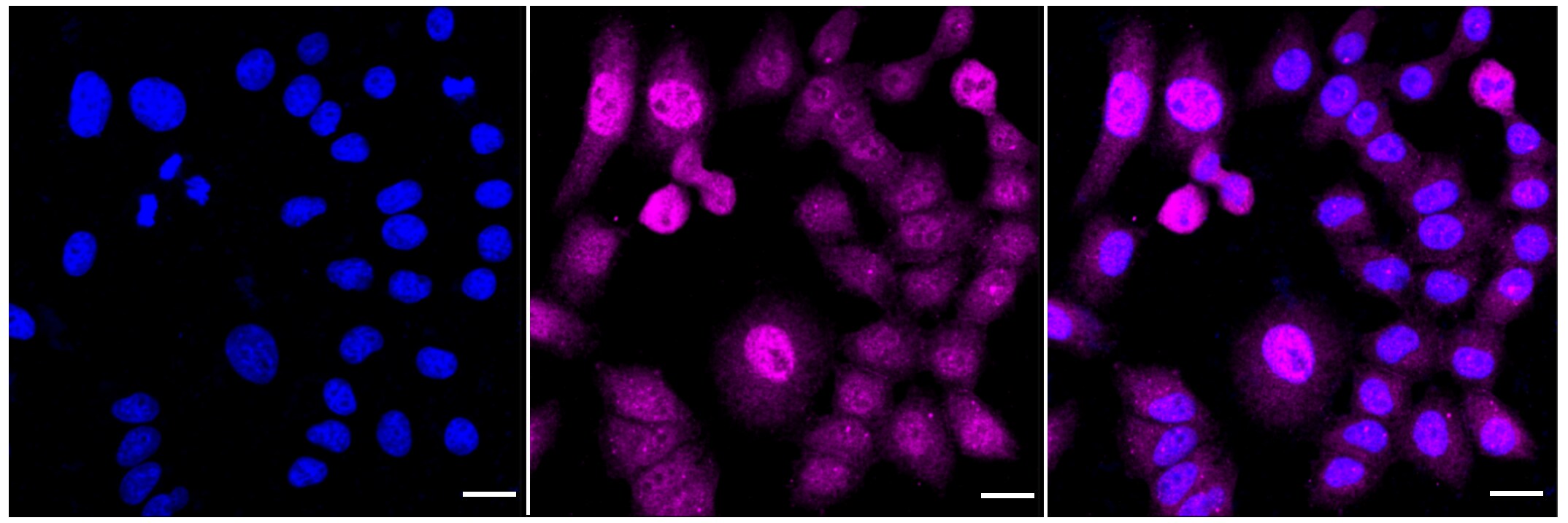 PKC zeta [p Thr560] Antibody (24GB890)