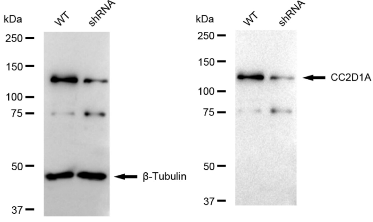 CC2D1A Antibody (23GB3045)
