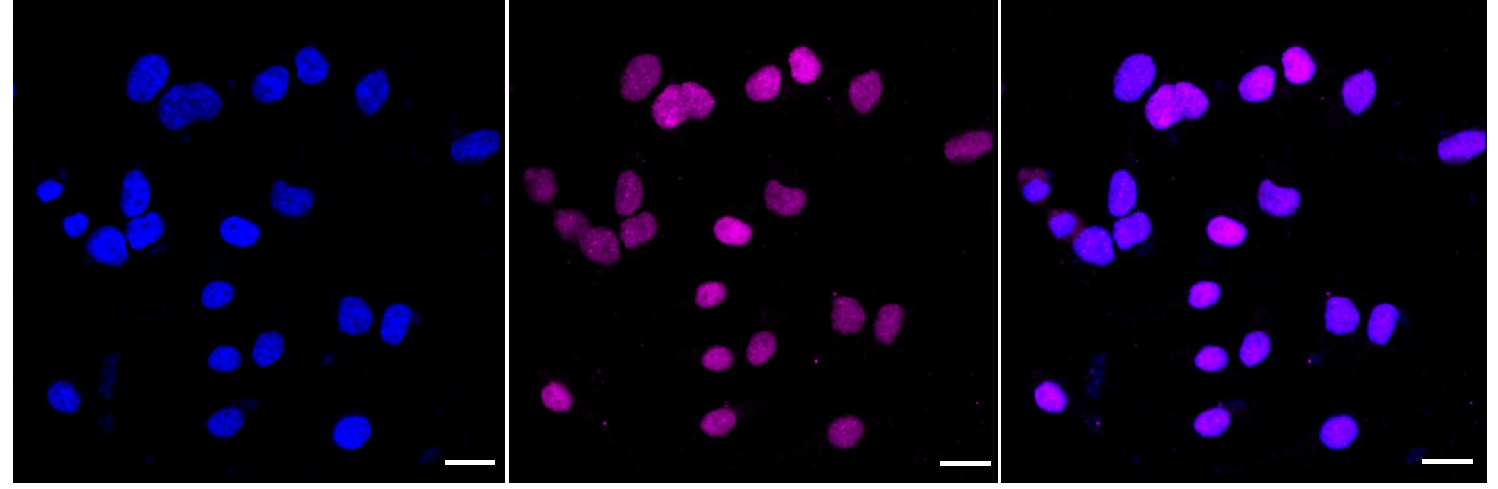 PIAS2/PIAS1 Antibody (24GB920)