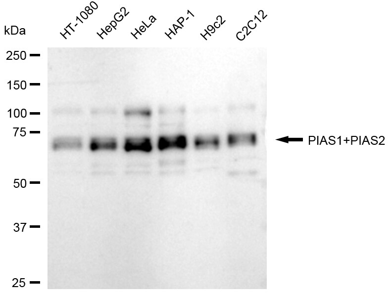 PIAS2/PIAS1 Antibody (24GB920)