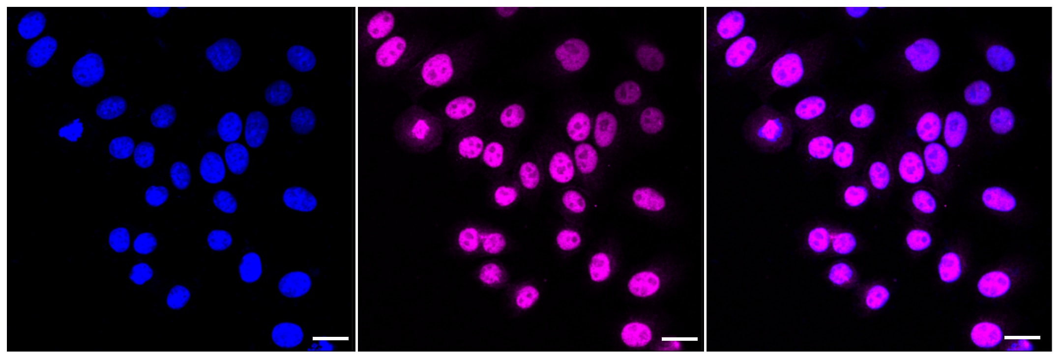Periostin/OSF-2 Antibody (24GB930)