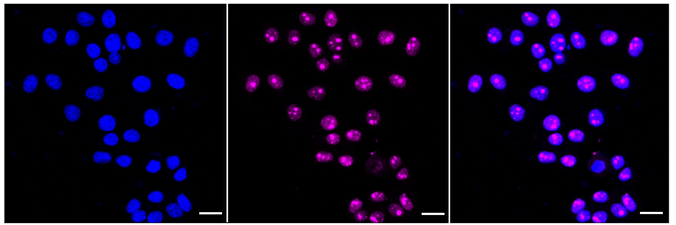 PHF8 Antibody (24GB945)