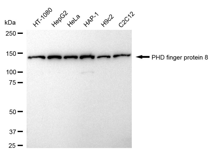 PHF8 Antibody (24GB945)