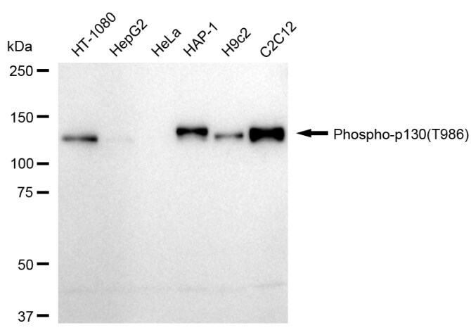 p130 [p Thr986] Antibody (24GB970)