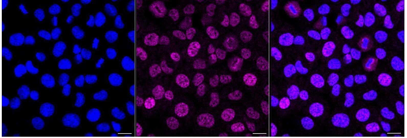 Nogo Receptor/NgR Antibody (24GB1005)