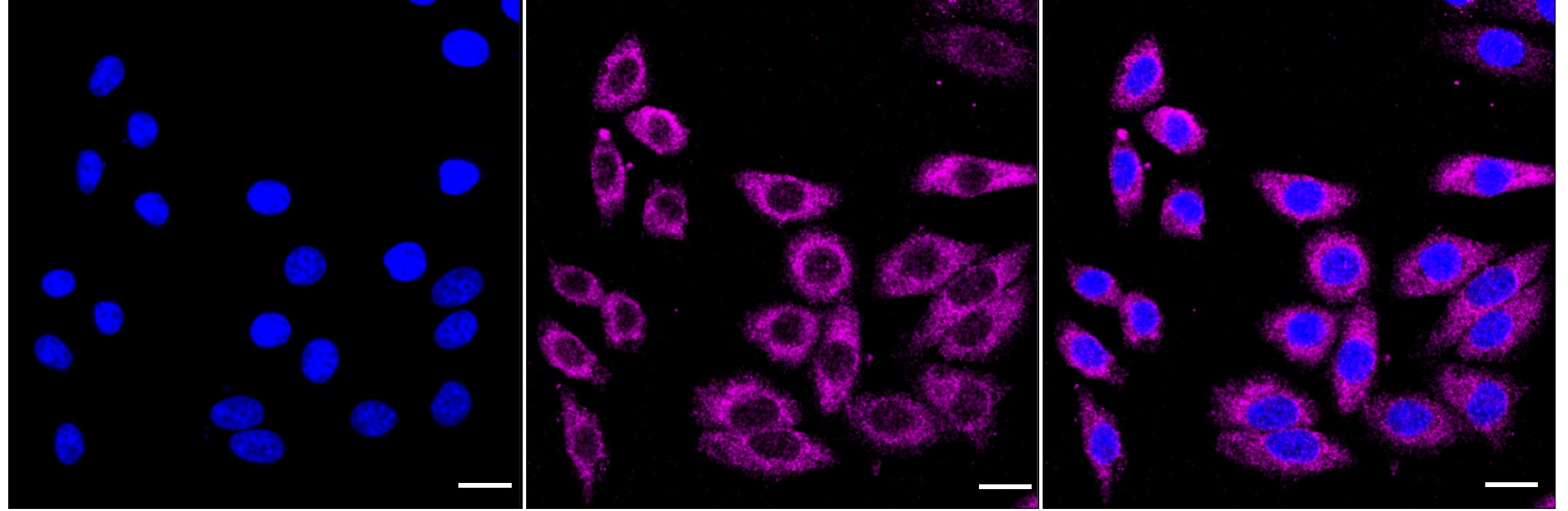 PUM1 Antibody (24GB1070)