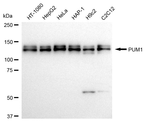 PUM1 Antibody (24GB1070)