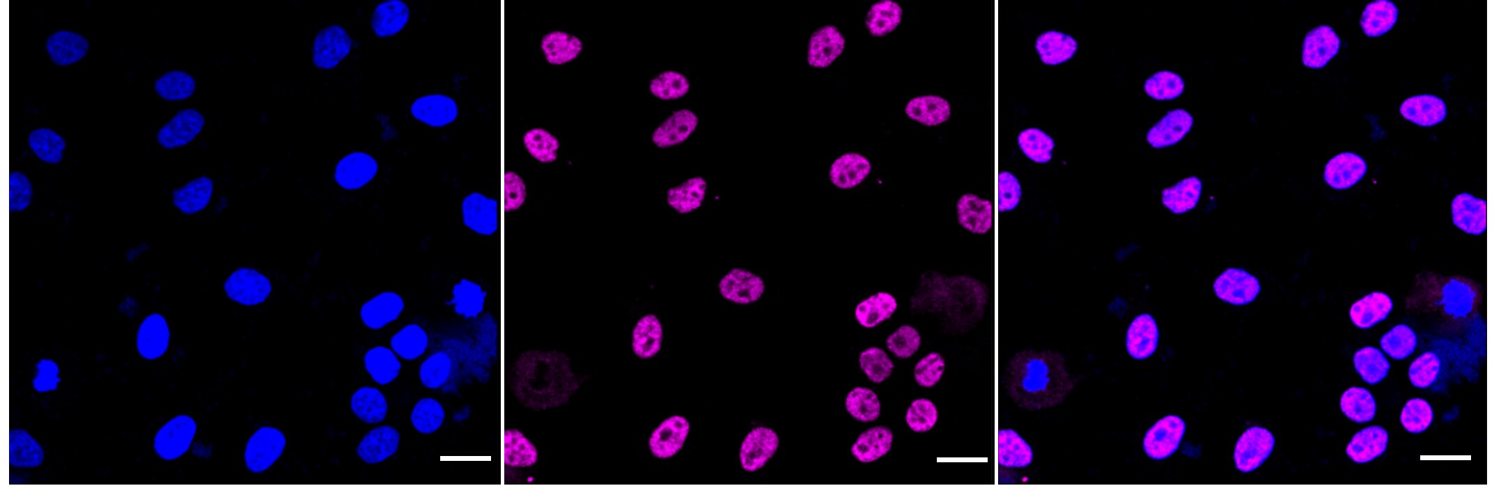 RNA Polymerase II/POLR2A [p Ser2] Antibody (24GB1175)