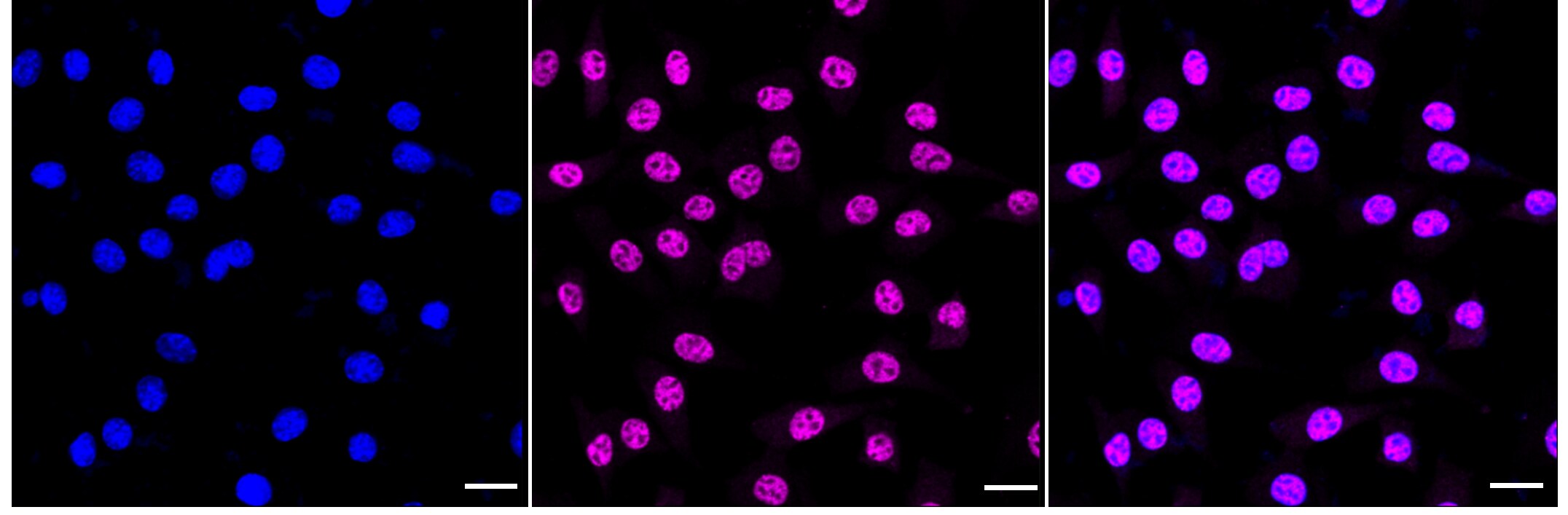 RNA Polymerase II/POLR2A [p Ser5] Antibody (24GB1180)
