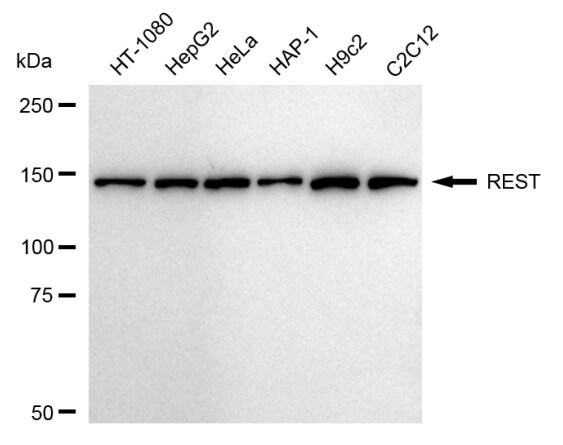 NRSF Antibody (24GB1200)