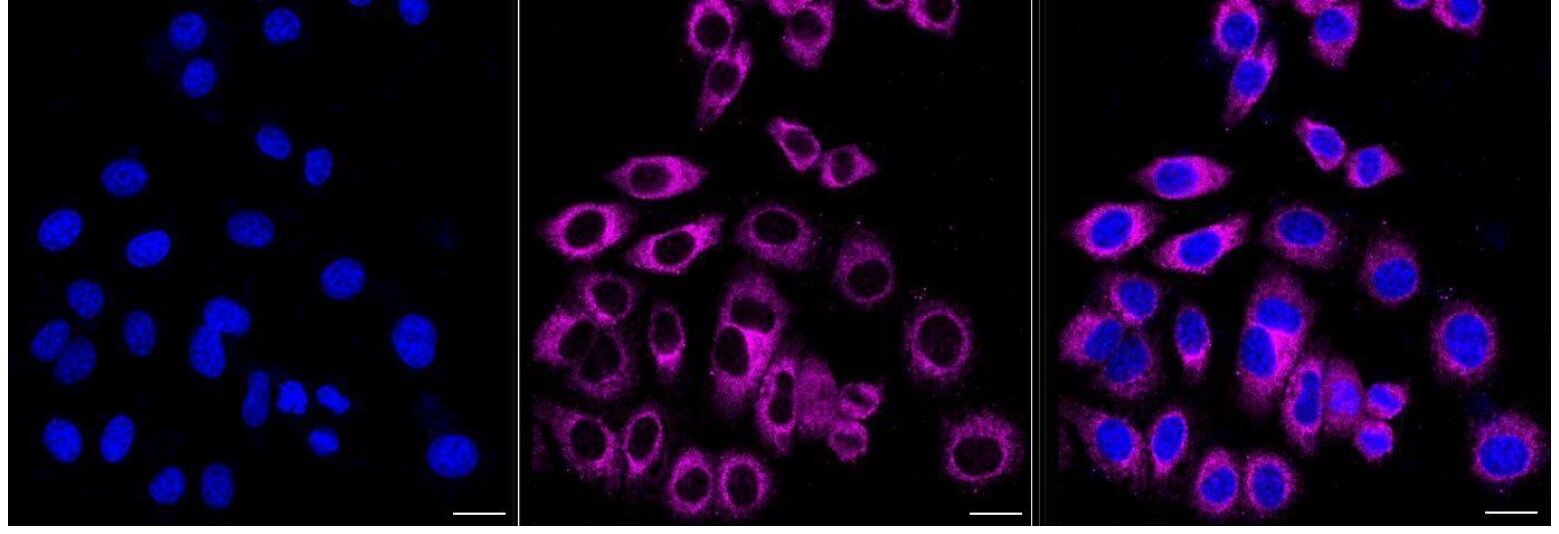 MNX1/HLXB9 Antibody (24GB1285)