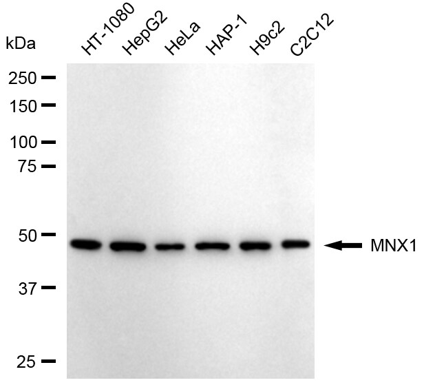 MNX1/HLXB9 Antibody (24GB1285)
