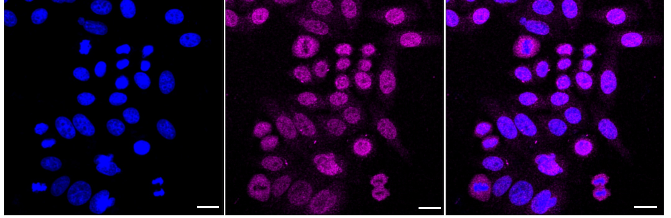 Phosphopantothenate-cysteine ligase Antibody (24GB1350)