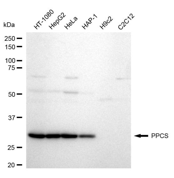 Phosphopantothenate-cysteine ligase Antibody (24GB1350)