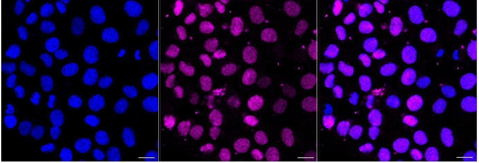 PIM1 Antibody (24GB1410)