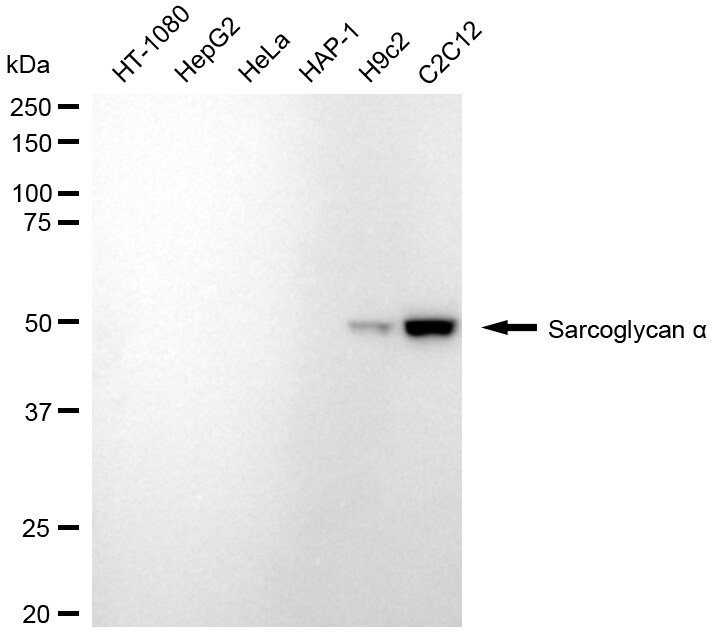 alpha-Sarcoglycan Antibody (24GB1460)