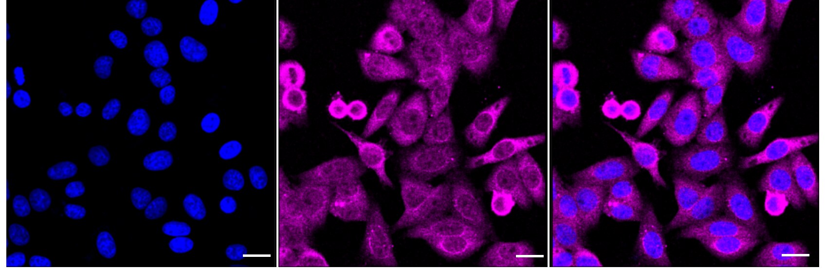 PKC beta Antibody (24GB1485)