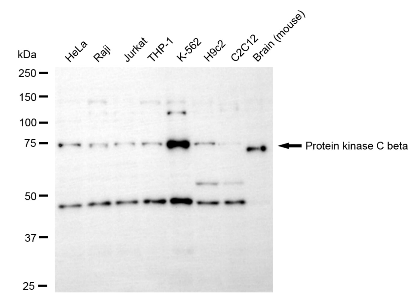 PKC beta Antibody (24GB1485)