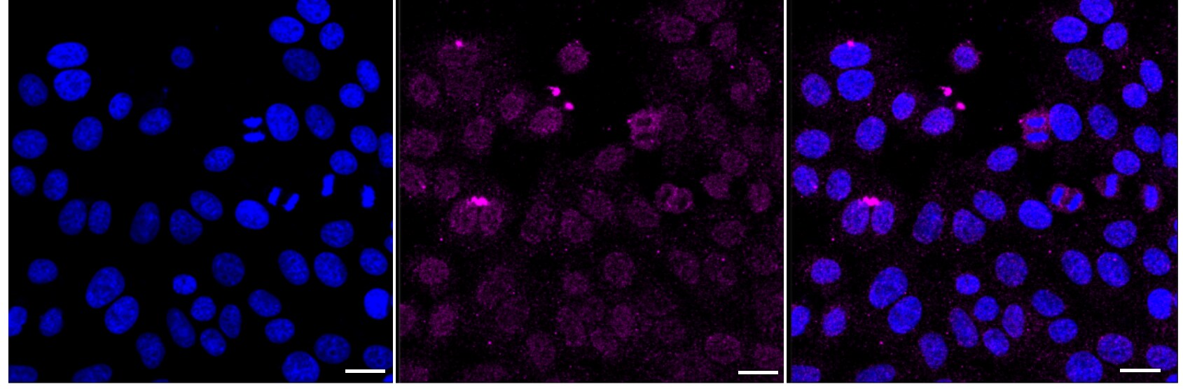 Serpin A3/alpha 1-Antichymotrypsin Antibody (24GB1490)