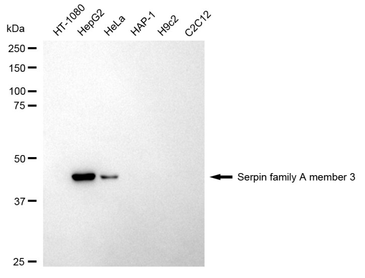 Serpin A3/alpha 1-Antichymotrypsin Antibody (24GB1490)