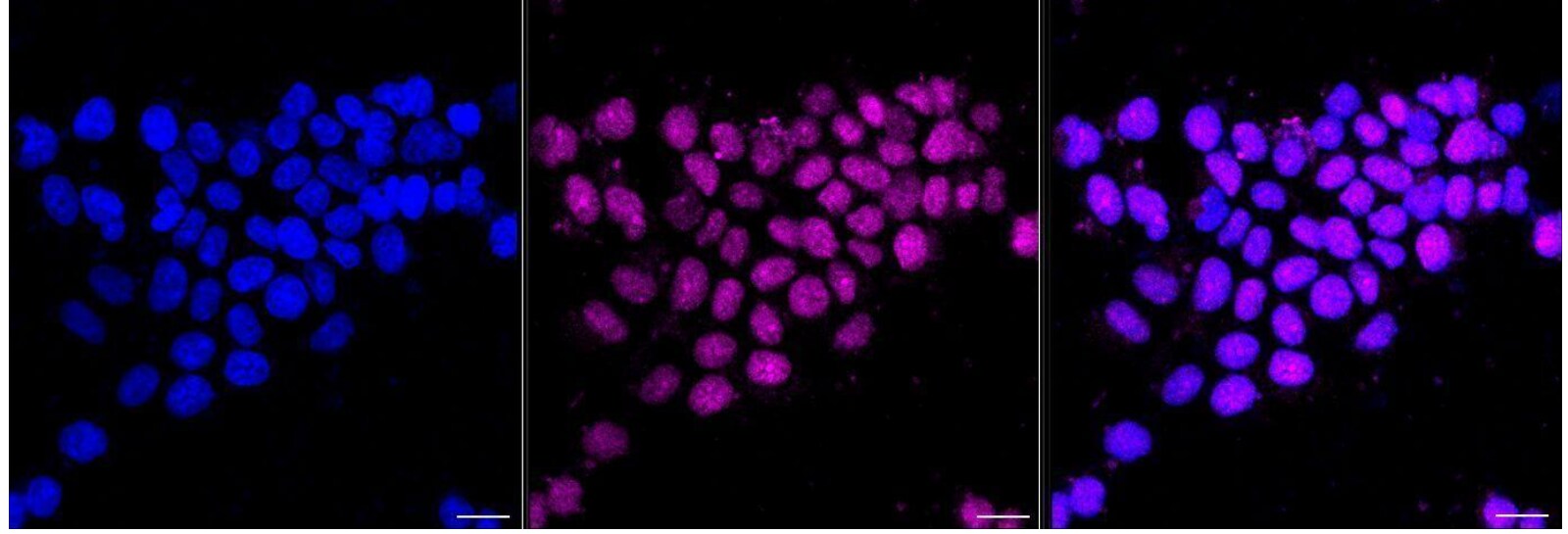 SUMO Activating Enzyme E1 (SAE1) Antibody (24GB1565)