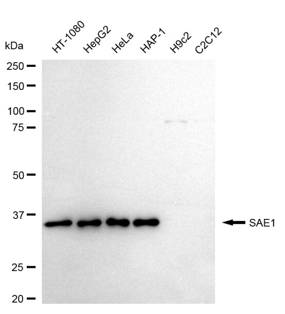 SUMO Activating Enzyme E1 (SAE1) Antibody (24GB1565)