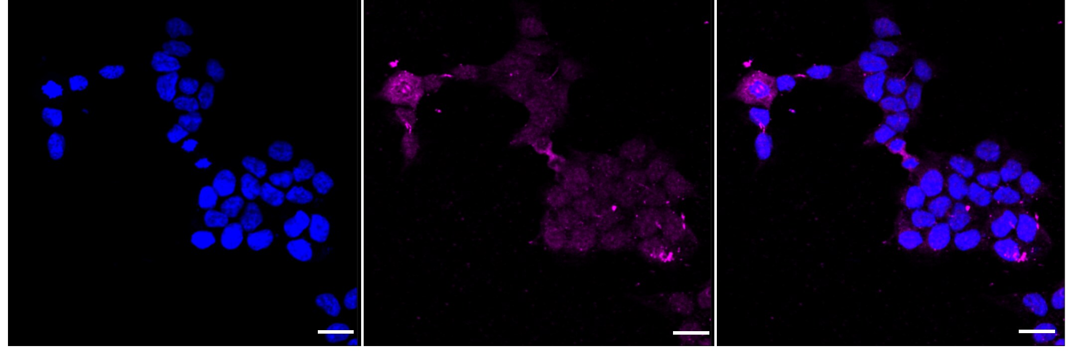 Protein Kinase D2 [p Ser876] Antibody (24GB1655)