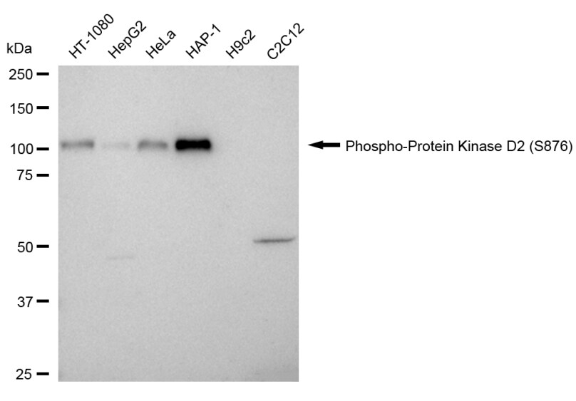 Protein Kinase D2 [p Ser876] Antibody (24GB1655)