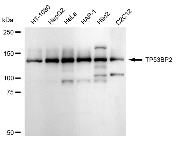 53BP2 Antibody (24GB2145)