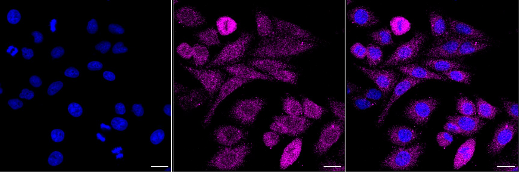 TPT1/TCTP Antibody (24GB2200)