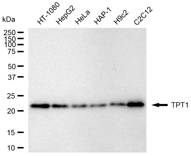 TPT1/TCTP Antibody (24GB2200)