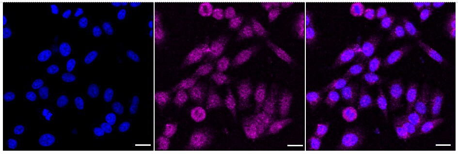 SF2 Antibody (24GB2255)