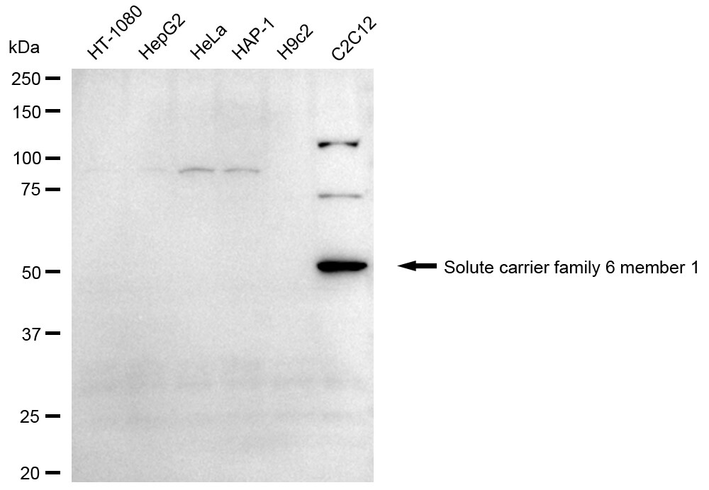 GAT-1/SLC6A1 Antibody (24GB2390)