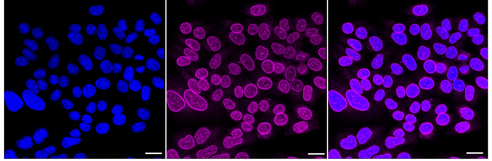 CRM1 Antibody (24GB2430)